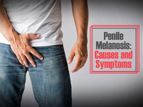 brown dick|Penile Discoloration: Causes, Treatment, When to Seek Help